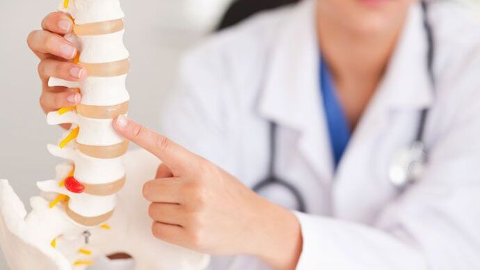 ការពន្យល់អំពី osteochondrosis lumbar លើគំរូនៃឆ្អឹងខ្នង